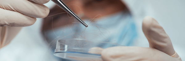 The Secret Stories Your Hair Can Tell: Unraveling Mysteries through Forensic Analysis